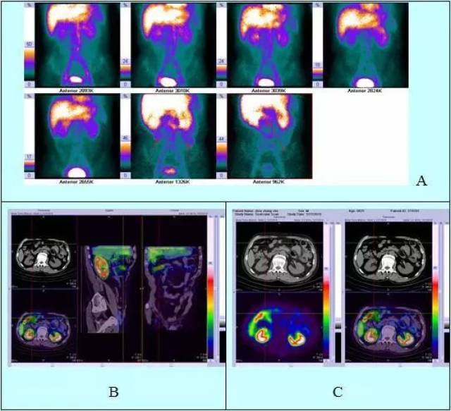 入侵者们的晚餐